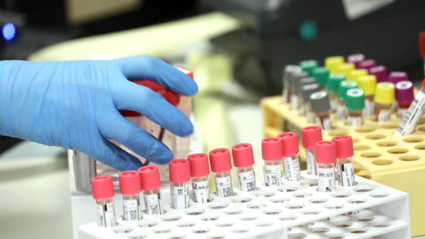 Omicron, nuova “variante” scoperta in Veneto: cosa sappiamo