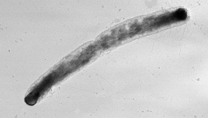 Il batterio della Xylella fastidiosa fa strage di ulivi in Puglia